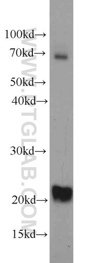 [11752-1-AP-20UL] TWIST2 Polyclonal antibody