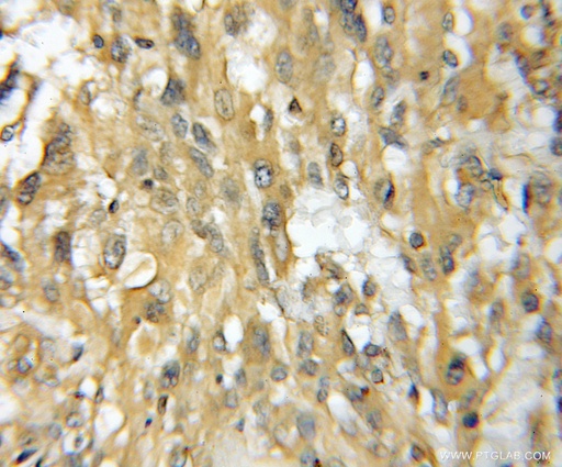 [11753-1-AP-20UL] TMOD4 Polyclonal antibody
