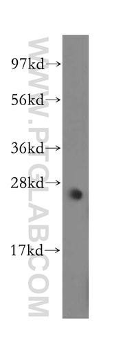 [11754-1-AP-20UL] MYF6 Polyclonal antibody