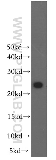 [11756-1-AP-150UL] RAB2B Polyclonal antibody