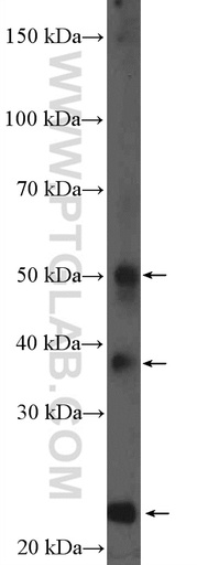 [11758-1-AP-150UL] HFE2 Polyclonal antibody
