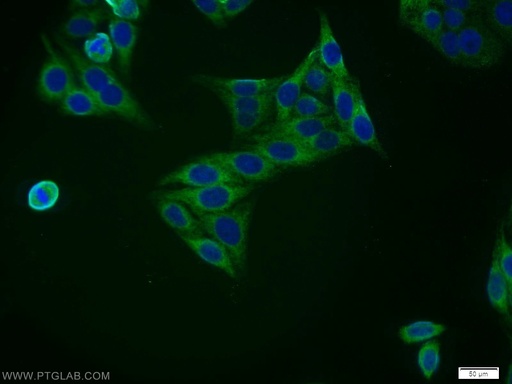 [11759-1-AP-150UL] ZNF395 Polyclonal antibody
