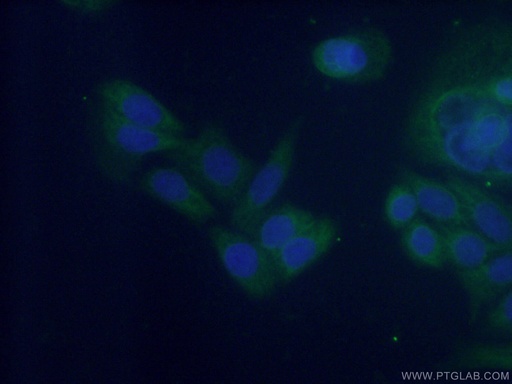 [11764-1-AP-150UL] NUDCD3 Polyclonal antibody