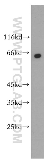 [11768-1-AP-150UL] PANK1 Polyclonal antibody