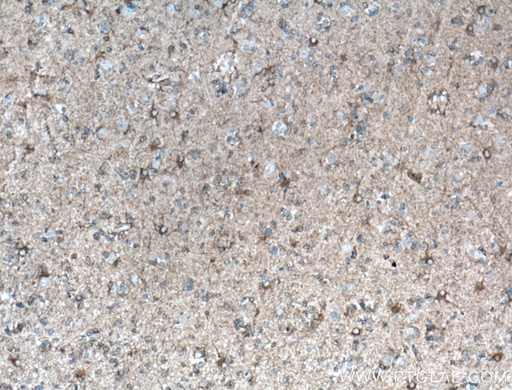 [11769-1-AP-150UL] SEPT8 Polyclonal antibody