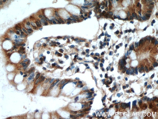 [11770-1-AP-150UL] ITLN1 Polyclonal antibody
