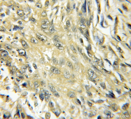 [11771-1-AP-150UL] CYP4B1 Polyclonal antibody
