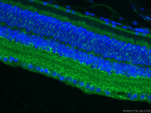 [11774-1-AP-150UL] RBP4 Polyclonal antibody