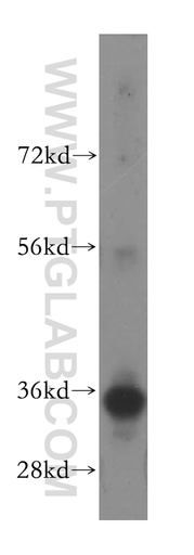 [11775-1-AP-20UL] FCN1 Polyclonal antibody
