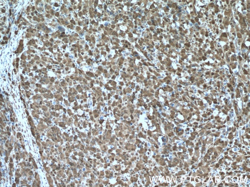 [11776-1-AP-150UL] NAMPT/PBEF Polyclonal antibody