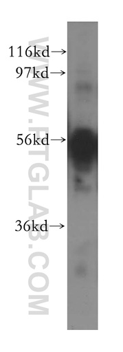 [11777-1-AP-150UL] CXADR Polyclonal antibody