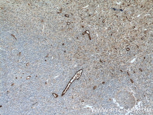 [11778-1-AP-20UL] VWF, VWFpp Polyclonal antibody