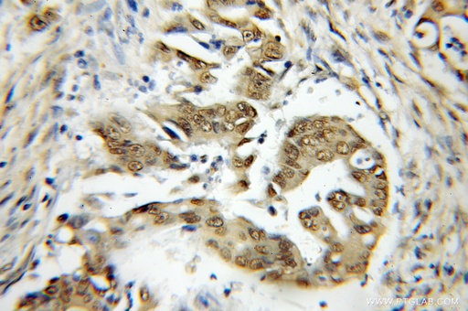 [11780-1-AP-20UL] TRAF7 Polyclonal antibody