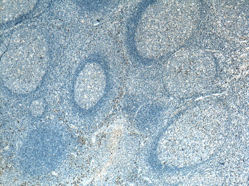 [11781-1-AP-20UL] IgG Kappa Light Chain Polyclonal antibody
