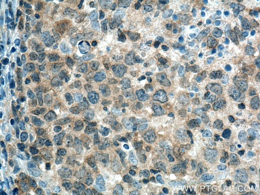 [11783-1-AP-20UL] PTPN22 Polyclonal antibody