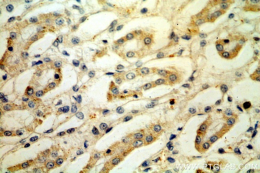 [11784-1-AP-150UL] LY96/MD2 Polyclonal antibody