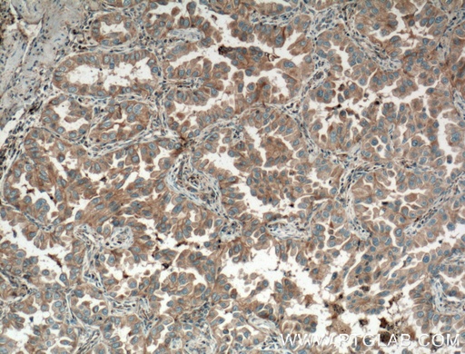 [11786-1-AP-150UL] Eotaxin Polyclonal antibody