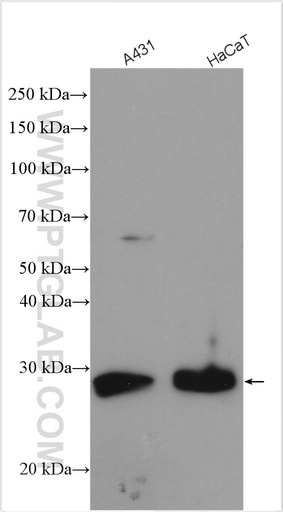 [11787-1-AP-20UL] MPZL2 Polyclonal antibody