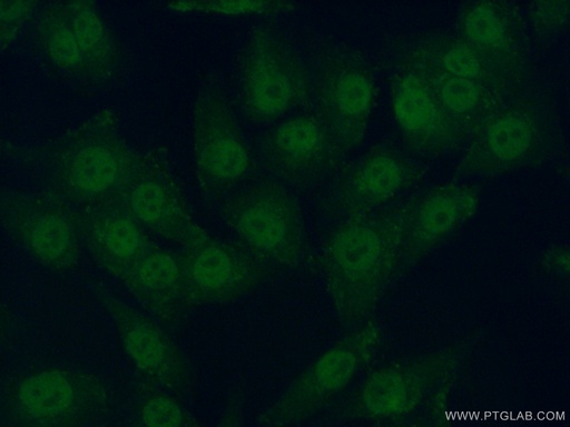 [11788-1-AP-20UL] PRIM2 Polyclonal antibody