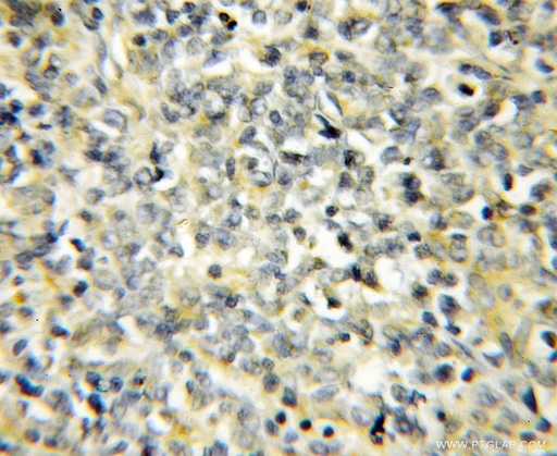 [11789-1-AP-20UL] NIPSNAP3B Polyclonal antibody