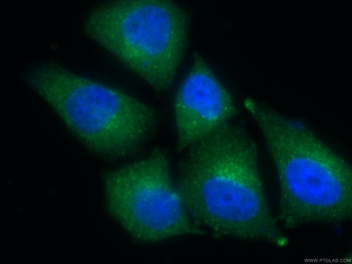[11795-1-AP-150UL] TPD52L2 Polyclonal antibody