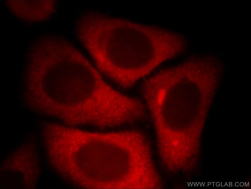 [11796-1-AP-20UL] KYNU Polyclonal antibody