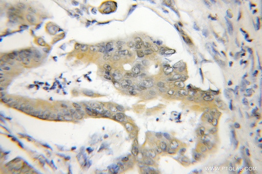 [11797-1-AP-150UL] NA14 Polyclonal antibody