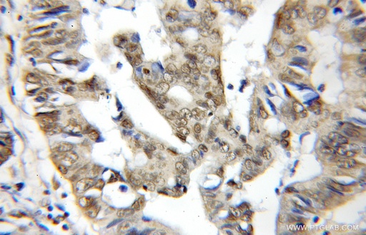 [11798-1-AP-150UL] BUD31 Polyclonal antibody