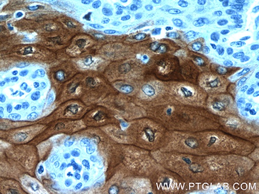 [11799-1-AP-20UL] CRNN Polyclonal antibody
