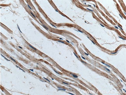 [11800-1-AP-150UL] POPDC3 Polyclonal antibody