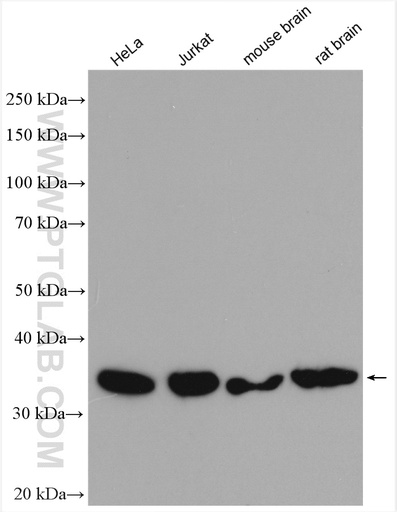 [11801-1-AP-20UL] RABGGTB Polyclonal antibody