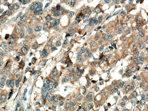 [11804-1-AP-20UL] Annexin A3 Polyclonal antibody
