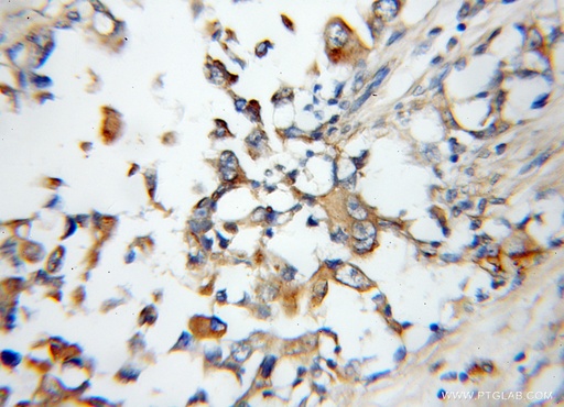 [11805-1-AP-150UL] Arylsulfatase D Polyclonal antibody