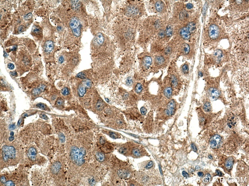 [11808-1-AP-20UL] RAB10 Polyclonal antibody