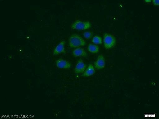 [11809-1-AP-20UL] PSG1 Polyclonal antibody