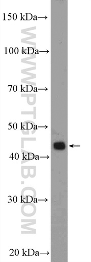 [11811-1-AP-20UL] SIRP Beta 1 Polyclonal antibody