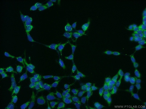 [11813-1-AP-20UL] CILP2 Polyclonal antibody