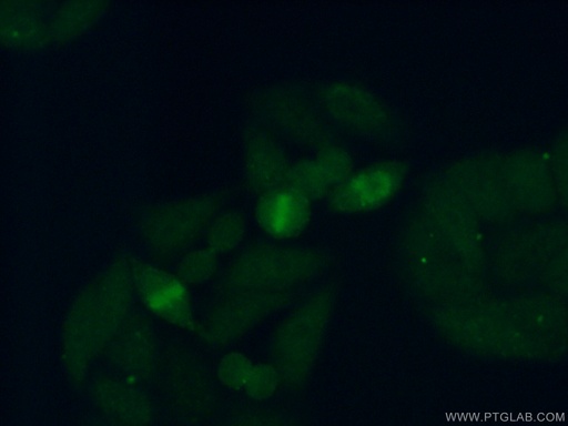 [11814-1-AP-20UL] RFC3 Polyclonal antibody