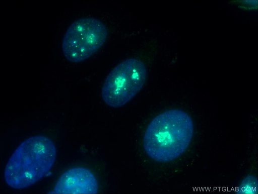 [11815-1-AP-20UL] NOLC1 Polyclonal antibody