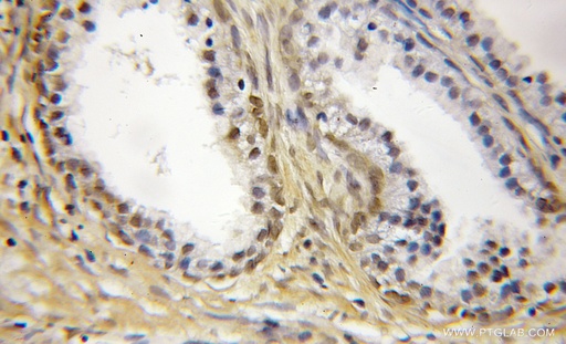 [11817-1-AP-20UL] SS18L2 Polyclonal antibody