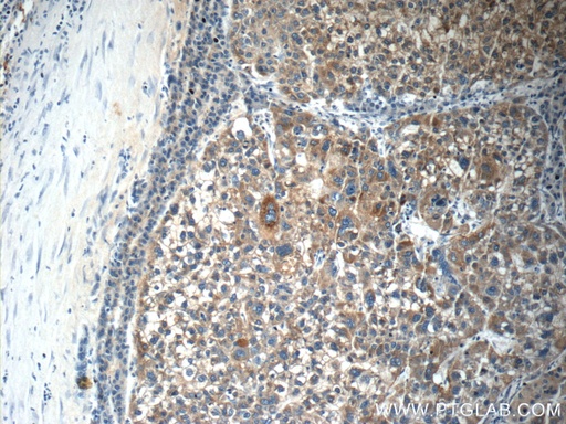 [11819-1-AP-20UL] C4BPA Polyclonal antibody