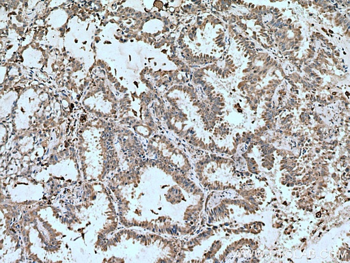 [11822-1-AP-150UL] VAMP5 Polyclonal antibody