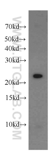 [11824-1-AP-150UL] CDC42EP2 Polyclonal antibody