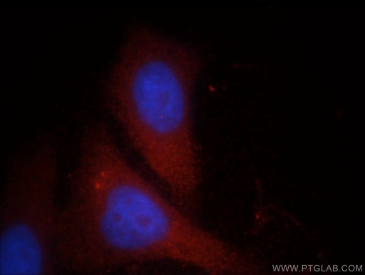 [11827-1-AP-150UL] FGL2 Polyclonal antibody