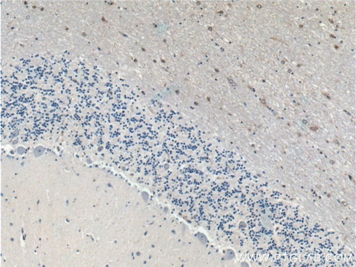 [11829-1-AP-150UL] ARPP-21 Polyclonal antibody