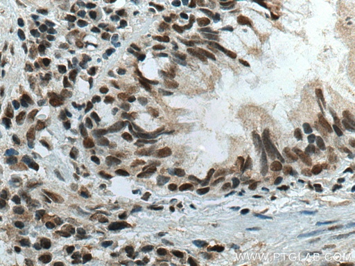 [11831-1-AP-150UL] CBX5 Polyclonal antibody