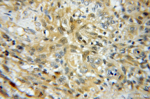 [11834-3-AP-20UL] UBE2K Polyclonal antibody