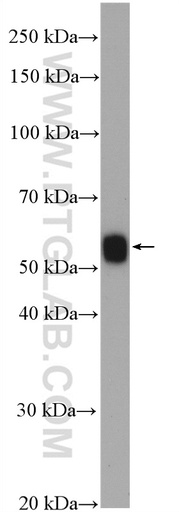 [11838-1-AP-20UL] HLA-DMA Polyclonal antibody