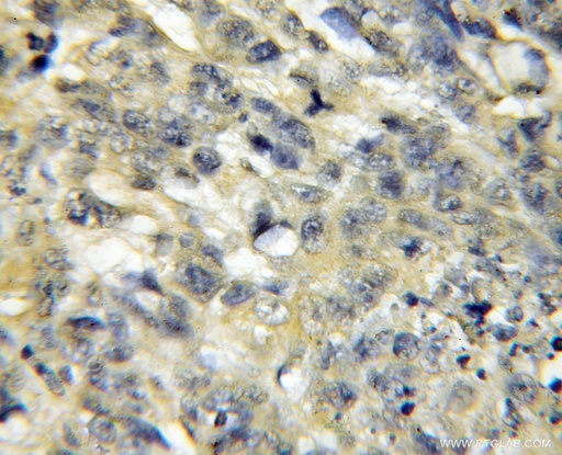[11839-1-AP-150UL] Surfactant protein D Polyclonal antibody