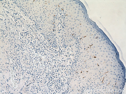 [11841-1-AP-150UL] Langerin Polyclonal antibody